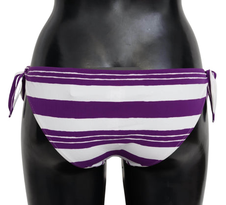 Dolce & Gabbana Chic Striped Bikini Bottom - Effortless Poolside Glamour - Hilstor